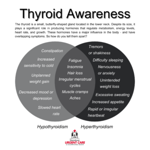 Venn diagram comparing symptoms of hypothyroidism and hyperthyroidism, highlighting shared symptoms like fatigue and unique symptoms for each condition.